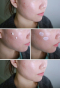 Крем для лица с экстрактом центеллы Cosrx Centella Blemish Cream