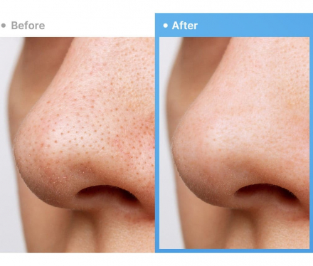 Гидрофильное масло Medicube Zero Pore Blackhead Deep Cleansing Oil