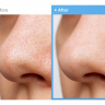 Гидрофильное масло Medicube Zero Pore Blackhead Deep Cleansing Oil