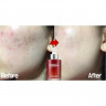Сыворотка для лица мульти-антиоксидантная Medi-Peel Cindella Multi-Antioxidant Ampoule
