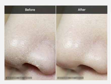 Пенка для умывания глубокоочищающая Medicube Zero Foam Cleanser