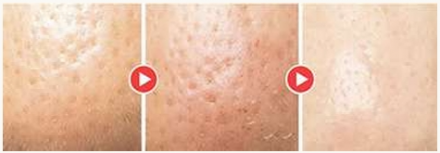 Ночная маска для восстановления кожи со спикулами и коллагеном Veramore Collagen Shot Pore Tightening Sleeping Pack
