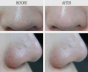 Маска-скраб для лица MISSHA Super Aqua Mini Pore Black Head Clear Stick