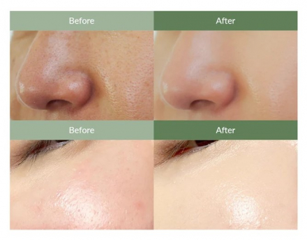 Средство для очищения пор Dr Althea Premium Quick Step Sebum Cleanser