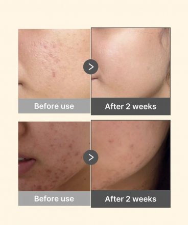 Сыворотка для лица капсульная для сияния кожи Medicube Kojic Acid Turmeric Niacinamide Serum