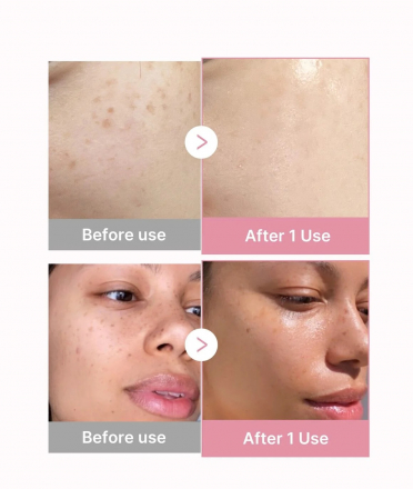 Сыворотка-мусс для лица с коллагеном и ПДРН Medicube PDRN Pink Collagen Bubble Serum