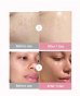 Сыворотка-мусс для лица с коллагеном и ПДРН Medicube PDRN Pink Collagen Bubble Serum