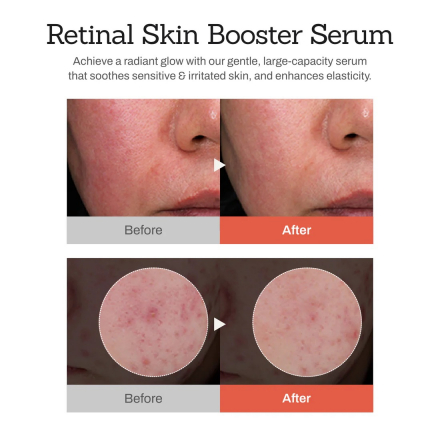Сыворотка для лица с ретиналем Meditherapy Retinal Skin Booster Serum