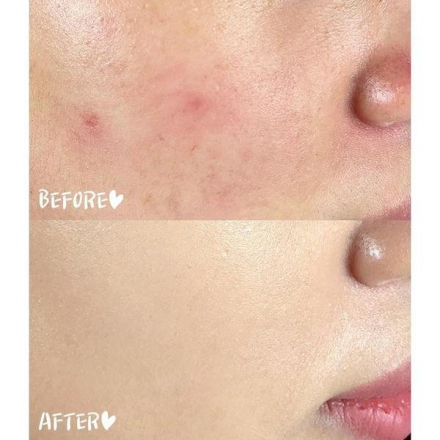 Кушон успокаивающий с экстрактом листьев чайного дерева для проблемной кожи SOME BY MI Killing Cover Moisture Cushion